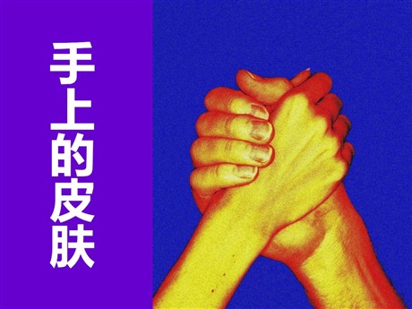 《手上的皮肤》PPT课件3