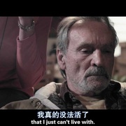 复合骨折 Compound Fracture
