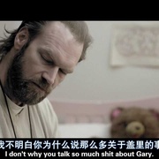 复合骨折 Compound Fracture