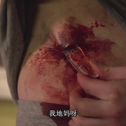 尸体解剖 Autopsy