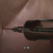 尸体解剖 Autopsy