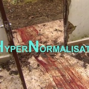 点击查看图片 超正常化 HyperNormalisation