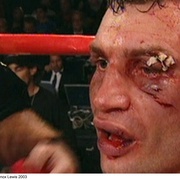 点击查看图片 克里琴科 Klitschko