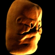 人体奥秘 Inside the Human Body