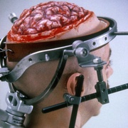 点击查看图片 是谁让我脑死了 Brain Dead
